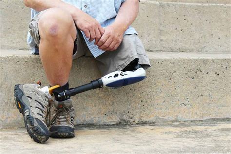 About Prosthetics Diller Law Personal Injury Law