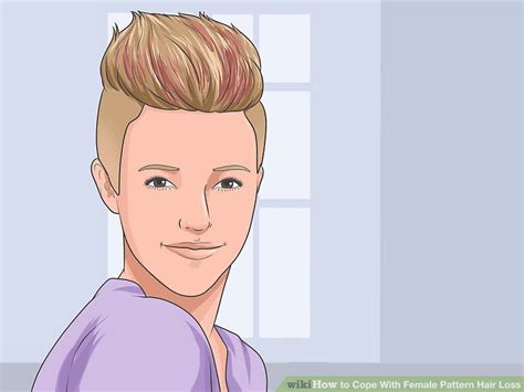 Hair loss in women due to hormones is also common. 3 Ways to Cope With Female Pattern Hair Loss - wikiHow