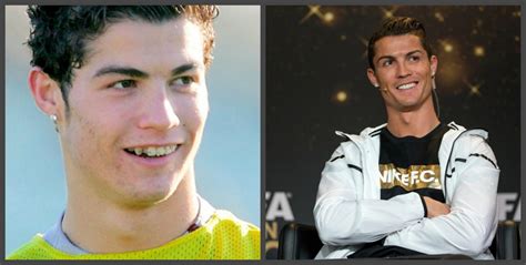 Cristiano Ronaldo Before After