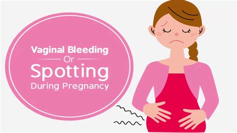 Women commonly see light spotting and bleeding during pregnancy. Vaginal Bleeding During Pregnancy -part 2 - YouTube