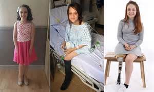 Tia Leigh With Nf1 Overjoyed To Have Her Leg Amputated Daily Mail Online