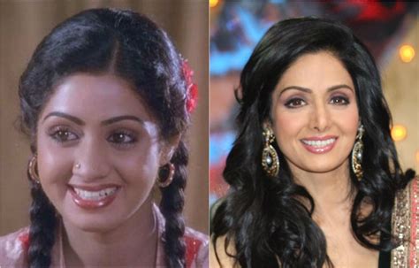 Bollywood Beauties Before And After Their Plastic Surgeries Life With