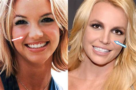Did Britney Spears Have Cosmetic Surgery Before And After 2018