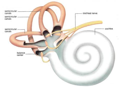 Medical Pictures Info Labyrinthitis