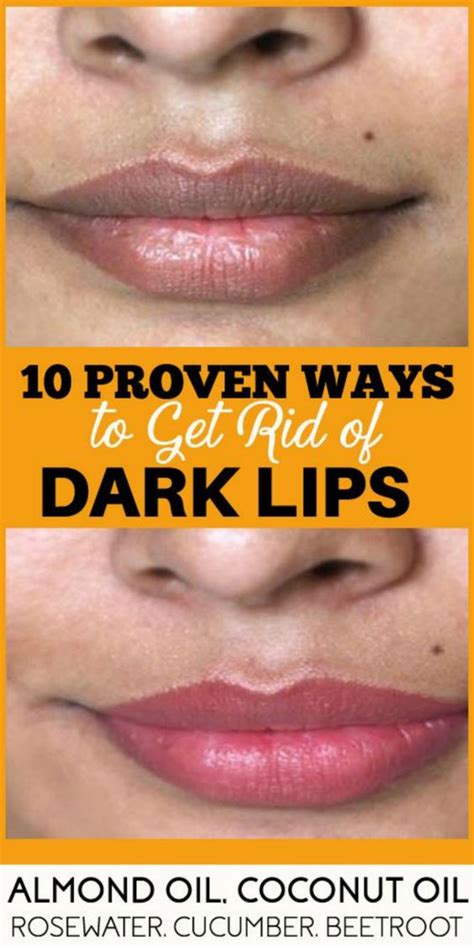 10 Home Remedies For Dark Lips
