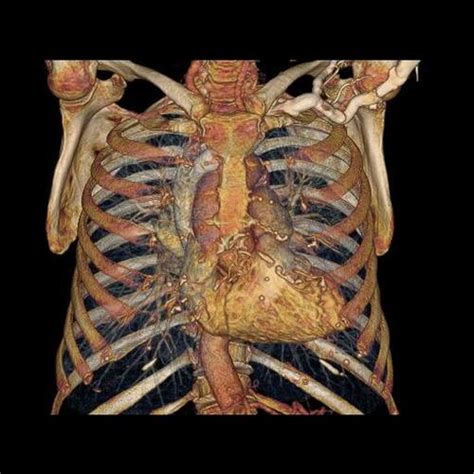 It is an organ that is part of the lymph system and works. Inside the human body in real time: GIFs demo the power of ...