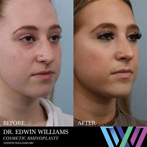 Williams Center Plastic Surgery Specialists Home