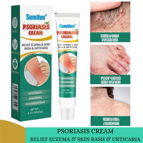 Authentic Psoriasis Eczema Cream Antibacterial Anti Itching Herbal