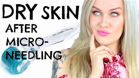 Why You Have Dry Skin After Dermarolling Youtube