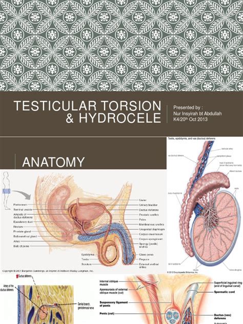 Testicular Torsion Hydrocele And Fournier Gangrene Pdf Medical Specialties Diseases And