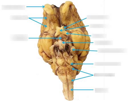 Sheep Brain Bottom Diagram Quizlet