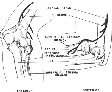 Tardy Radial And Ulnar Nerve Palsy In Journal Of Neurosurgery Volume
