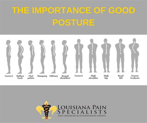 The Importance Of Good Posture Louisiana Pain Specialists Pain Management