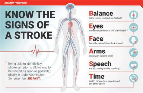 First Aid For Stroke Dr Kashi Stroke Symptoms Stroke Recovery