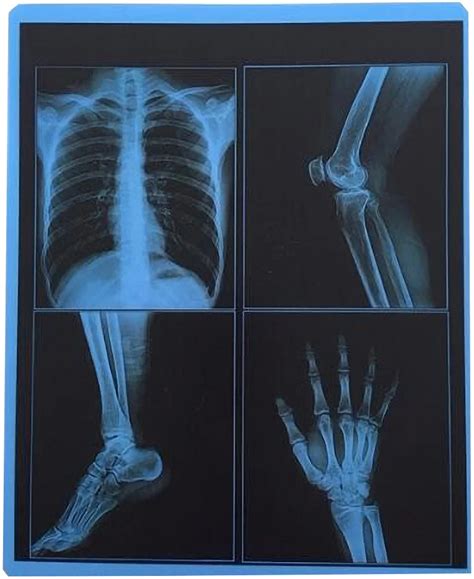 Thermal X Ray Film Radiographic Filmmedical Dental X Ray Film Blue