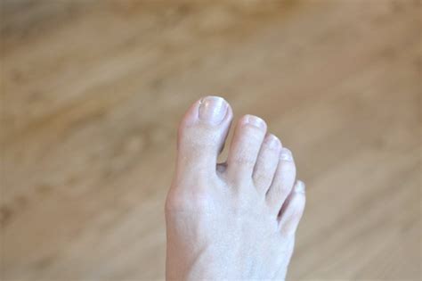 Home Remedy For Thick Toenails Leaftv