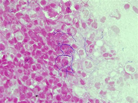 Filamentous Bacteria On Cytology Gram Positive Bacteria Wi Flickr