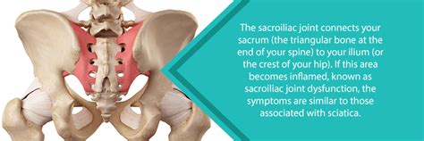 Sacroiliac Joint Dysfunction Nj Spine And Orthopedic