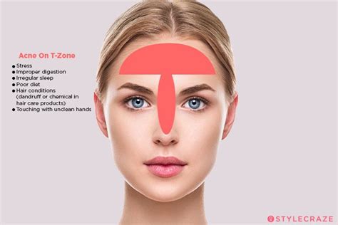 Acne Face Map What Your Breakouts Are Trying To Tell You Face