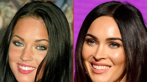 Megan Fox Before And After Plastic Surgery 2022