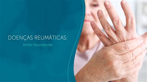 Doen As Reum Ticas Artrite Reumatoide Youtube