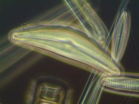 Diatoms Cloudy Days And Microscopes Cloudy Nights