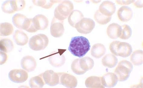 What Is The Difference Between Monocytes And Lymphocytes Pediaacom