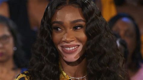 Winnie Harlow Gets Real About Dating Exclusive
