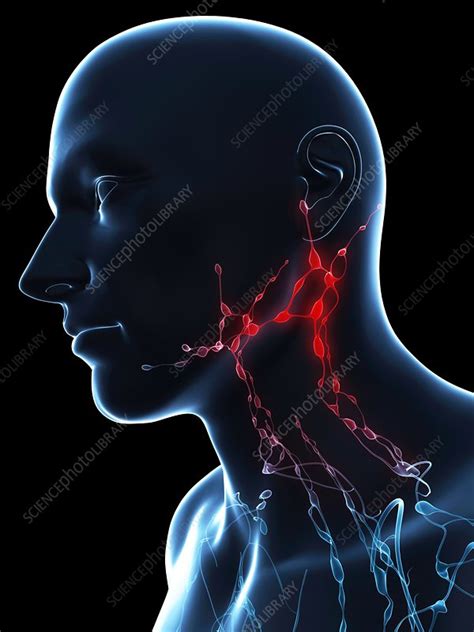 Inflamed Lymph Nodes Conceptual Artwork Stock Image F0055700