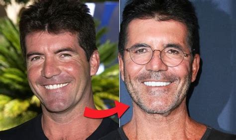 Simon Cowell Plastic Surgery Before And After Images Explored The
