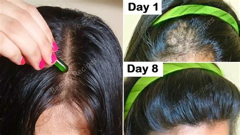 Dermatologist shares hair care tips for healthy and. vitamin e for hair loss - Kobo Guide