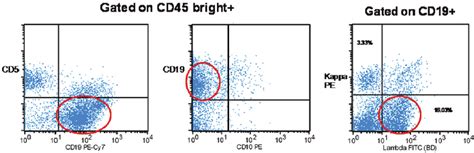 flow cytometry monotypic cd19 positive b cells that have a download scientific diagram