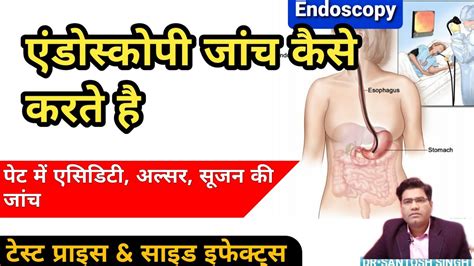 Endoscopy Test Procedure (Explained in Hindi) | Upper GI Endoscopy Use