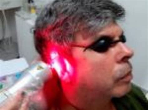Terapia A Laser Alternativa Para Tratamento De Zumbido Do Ouvido