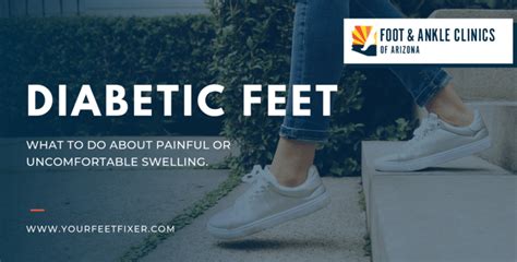 What To Do About Diabetic Feet Swelling Foot And Ankle Clinics Of Arizona