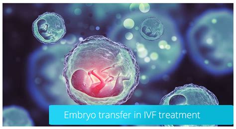 Embryo Transfer In Ivf Treatment Istanbul Ivf Center Infertility