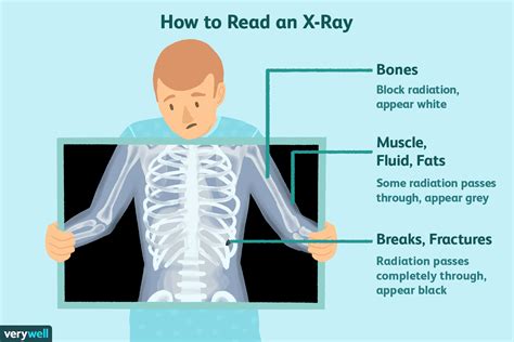 How To See X Rays On Mychart