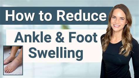 How To Treat Foot Ankle And Leg Lymphedema And Swelling From A