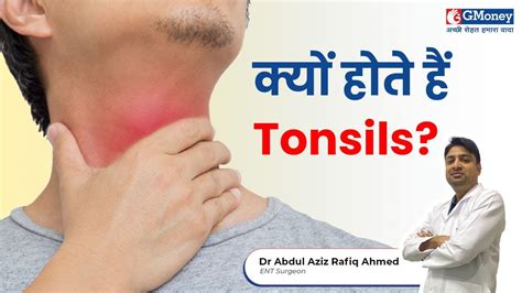 Treatment For Tonsil Infection Causes And Symptoms Gmoney Health Show