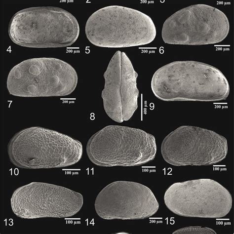 Scaled Images Of Benthic Foraminifera Species Obtained From Shallow