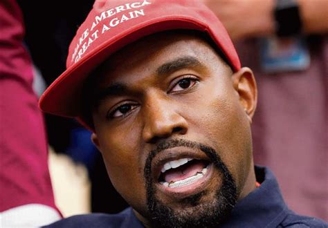 Kanye West Replaces Teeth With Titanium Gnashers The Tribune India