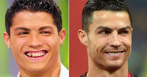 Cristiano Ronaldo antes y después La Verdad Noticias