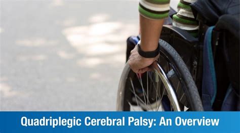 Quadriplegic Cerebral Palsy Causes Symptoms And Treatment