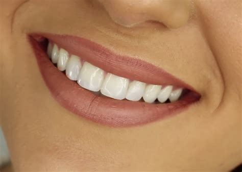 4 Ways That Braces Improve Your Health Schalo Orthodontics