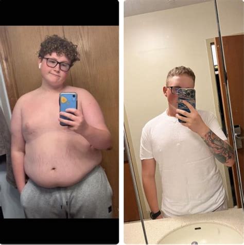 Male At 510 Drops 70 Pounds In 18 Months