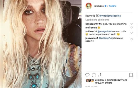 Kesha Shows Off Her Freckles In Gorgeous Makeup Free Selfie