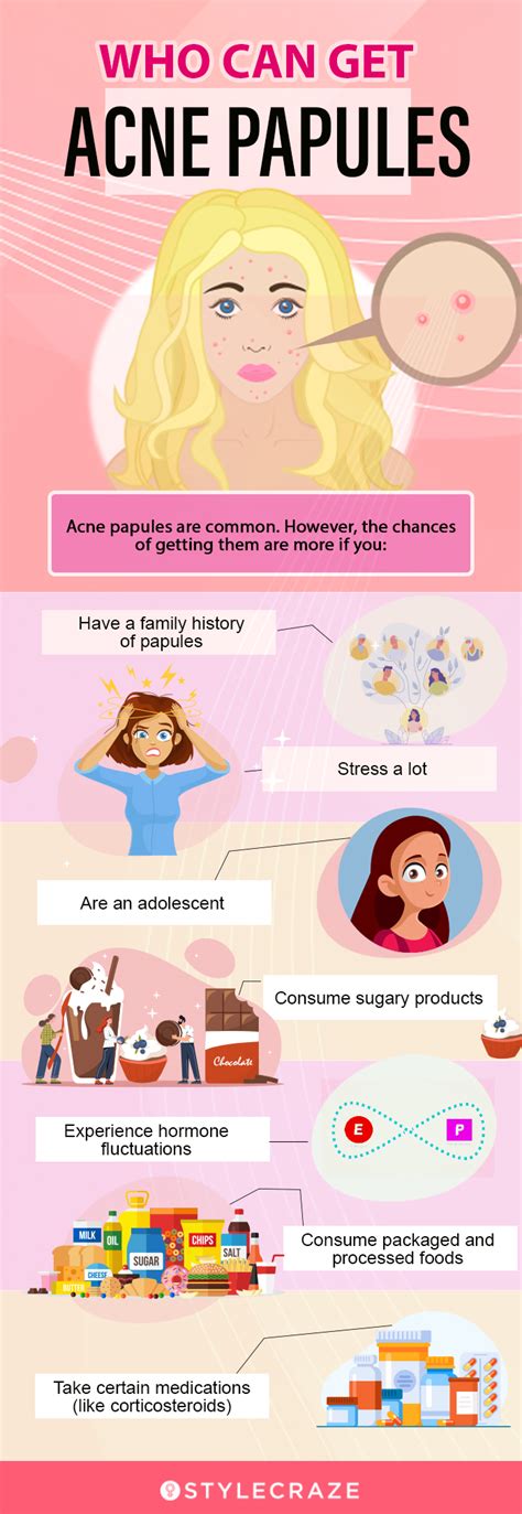 Acne Papules Potential Causes And How To Get Rid Of Them