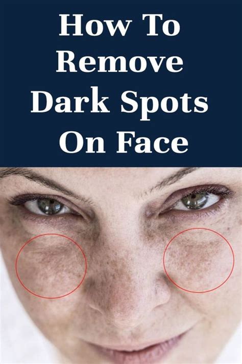 remove dark spots in just 3 nights by doing this watch this trick