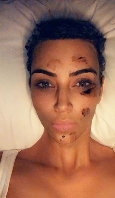 Photos The Pain Was So Unbearable Kim Kardashian Opens Up About Her