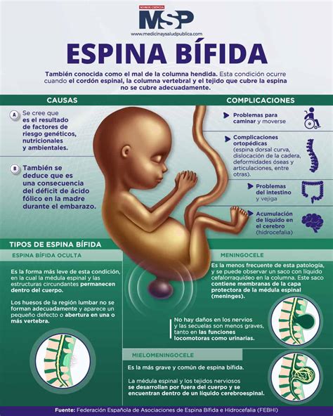 Espina Bífida Infografía